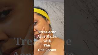 Clear Skin Secrets How To Treat Acne  shorts [upl. by Cardie]