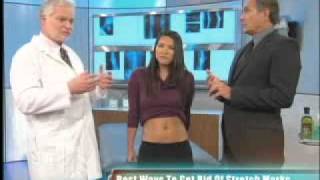 Dr Harold Lancer  The Doctors  Stretch Mark Correction [upl. by Bevus]