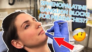 Sphenopalatine Ganglion Block for Treatment of Headaches [upl. by Atinahs194]