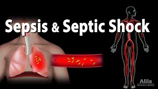 Sepsis and Septic Shock Animation [upl. by Areid369]