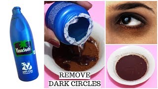 Remove Dark Circles Fast And Overnight  Dark circles under eyes home remedy [upl. by Mosa594]