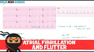 Rate and Rhythm  Atrial Fibrillation and Atrial Flutter [upl. by Lawry]