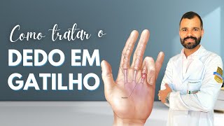 Como Tratar o Dedo em Gatilho [upl. by Oicneconi]