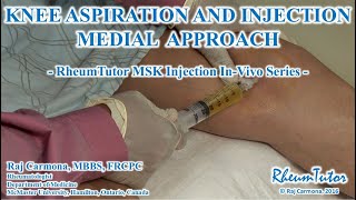 KNEE ASPIRATION  INJECTON MEDIAL APPROACH  InVivo Series [upl. by Mcripley]