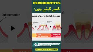 Periodontitis 🦷  Dr Muhammad Ahad Shabbir [upl. by Konstance148]