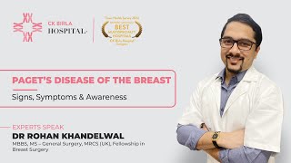 Paget’s Disease of the Breast  Dr Rohan Khandelwal  The Breast Center CK Birla Hospital [upl. by Aihsek]