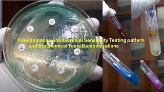 Pseudomonas Antimicrobial Sensitivity Testing pattern and Biochemical Tests Demonstrations [upl. by Yaras981]