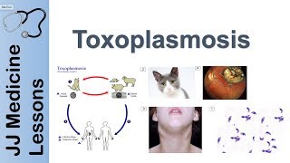 Toxoplasmosis  Acquired vs Congenital  Signs Symptoms Diagnosis and Treatment [upl. by Eittam]