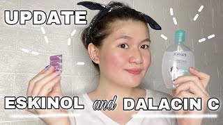 Inexpensive Acne Solution – ESKINOL and DALACIN C UPDATE  EY BELZY [upl. by Cooperman]