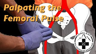 Palpating the Femoral Pulse [upl. by Ateekan551]