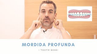 TOOTH BOSS  MORDIDA PROFUNDA Y ALINEADORES 👨🏻‍⚕️ Ortodoncia en Murcia [upl. by Johnsson]