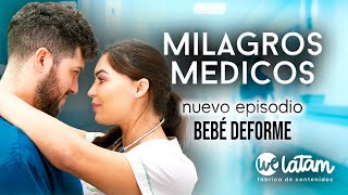 BEBÉ DEFORME  EPISODIO 6 MILAGROS MÉDICOS [upl. by Eamaj215]