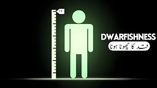 The BEST Treatment of Dwarfishness  Homeopathic Medicine  By Dr Ataullah [upl. by Aronle]