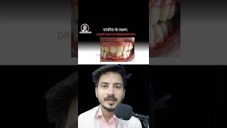 Periodontitis Symptomsपायरिया के लक्षण [upl. by Kral]