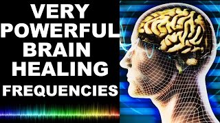 EXTREME BRAIN HEALING FREQUENCIES FOR STUDY FOCUS MIND POWER CONFIDENCE MEDITATION  MUST TRY [upl. by Yllrebmik]