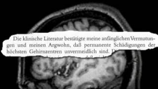 Verringerung der intellektuellen Fähigkeiten durch neuroleptische Behandlung [upl. by Sahc]