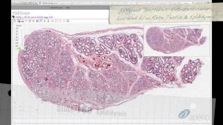 Histology Helper  Male Reproductive Histology [upl. by Hoenack]