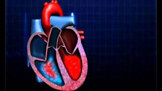 Atrial Septal Defect [upl. by Nolur613]