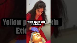 Yellow peel for akin exfoliation at Delhi  8287001211  peels peeloff skincareroutine [upl. by Aljan]