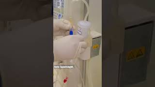 Procedure Name  ndt nephrology hemodialysis dialysis dialysistechnician ABO [upl. by Liberati]