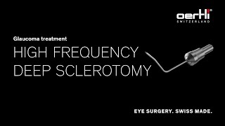 Spotlight HFDS High Frequency Deep Sclerotomy  Glaucoma treatment [upl. by Teirtza221]