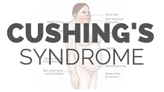 What is Cushing Syndrome  pathology symptoms causes diagnosis treatment [upl. by Marris]