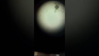 zooplankton in water experiment zoology insects science msc [upl. by Aztin]