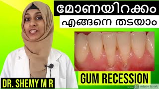 മോണയിറക്കം എങ്ങനെ തടയാംEng subs 2022  How to prevent GUM RECESSIONMalayalam Dr SHEMY MR [upl. by Tiffi47]