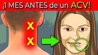 7 SEÑALES de ADVERTENCIA 1 MES ANTES DE UN ACV ICTUS CEREBRAL [upl. by Meerek]