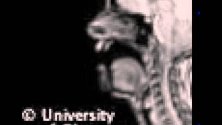 MRI uvular fricative [upl. by Mort]