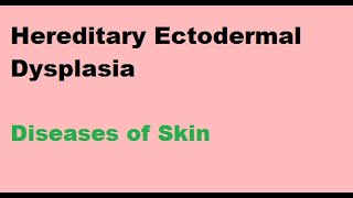 Hereditary Ectodermal Dysplasia  Diseases of Skin [upl. by Kelula623]