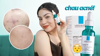 EL MEJOR SERUM PARA ELIMINAR EL ACNÉGRANOS effaclar serum La roche posay  Evelynlugod [upl. by Richmound]