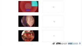 VisionBased Neurosurgical Guidance Unsupervised Localization and CameraPose Prediction 2 [upl. by Alexandros]