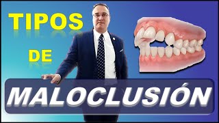 TIPOS DE MALOCLUSION DENTAL  FACTORES QUE CAUSAN [upl. by Skantze]