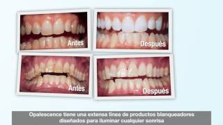 Opalescence Sistemas de Blanqueamiento – Opciones para Tratamiento Personalizado [upl. by Lawlor305]