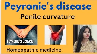 Peyronies disease  Curved penis symptomscauses amp Homeopathic medicine  Treatment without surgery [upl. by Chinua]