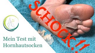 Podologin Andrea Testet Hornhautsocken SCHOCK [upl. by Dorfman]