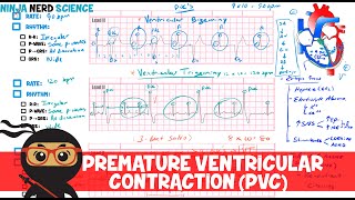 Rate and Rhythm  Premature Ventricular Contraction PVC [upl. by Simsar409]