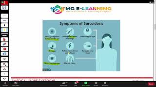 Sarcoidosis  Respiratory Medicine  UrduHindi [upl. by Spearing]