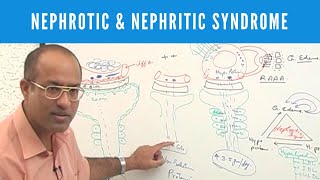 Nephrotic and Nephritic Syndrome  Causes Symptoms amp Treatment🩺 [upl. by Anirdnajela]