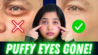 👀 How to Get Rid of Eye Puffiness and Under Eye Bags [upl. by Puduns]