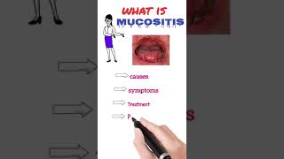 mucositis amp its causes symptoms prevention and treatment mucositis [upl. by Eitsym]