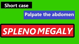 Medicine short case for MBBS  question amp answer for splenomegaly [upl. by Berne]