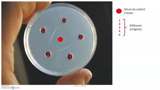Structure et mode daction des anticorps immunoglobulines  relation spécifique anticorpsantigène [upl. by Alohcin]