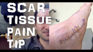 Help Fix Fascia Muscle Adhesions amp Scar Tissue Pain Doing This [upl. by Haran197]