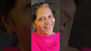 പല്ല് വെറുതെ പറിച്ചുകളയല്ലേ dentalvideos dentalclinic dentalcare dentist thedentalviews [upl. by Anerys604]