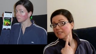 Does light therapy for rosacea work Watch unedited video  Rosy JulieBC [upl. by Ldnek249]