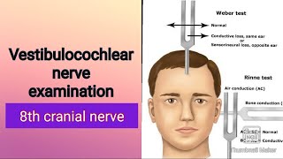 8th cranial nerve examination Physiology [upl. by Perla159]