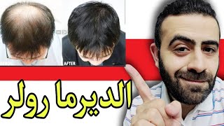 الديرما رولر لعلاج الصلع الوراثي و تكثيف و اطالة شعر اللحية  Derma roller for hair regrowth [upl. by Capone]