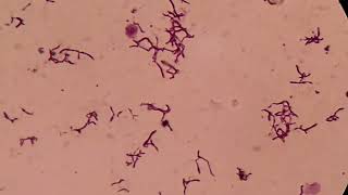 Branching Gram positive Rods Microscopy at various magnifications [upl. by Lakym516]